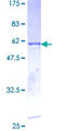 CDK5 Protein - 12.5% SDS-PAGE of human CDK5 stained with Coomassie Blue
