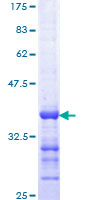 CDK5 Protein - 12.5% SDS-PAGE Stained with Coomassie Blue.