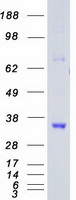 CDK5 Protein - Purified recombinant protein CDK5 was analyzed by SDS-PAGE gel and Coomassie Blue Staining