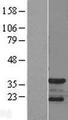 CDK5R1 Protein - Western validation with an anti-DDK antibody * L: Control HEK293 lysate R: Over-expression lysate