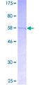 CDK5R1 Protein - 12.5% SDS-PAGE of human CDK5R1 stained with Coomassie Blue