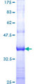 CDK5R1 Protein - 12.5% SDS-PAGE Stained with Coomassie Blue.