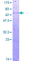 CDK5R2 Protein - 12.5% SDS-PAGE of human CDK5R2 stained with Coomassie Blue