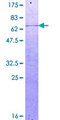 CDK5R2 Protein - 12.5% SDS-PAGE of human CDK5R2 stained with Coomassie Blue