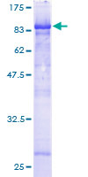 CDK5RAP3 Protein - 12.5% SDS-PAGE of human CDK5RAP3 stained with Coomassie Blue