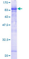 CDK5RAP3 Protein - 12.5% SDS-PAGE of human CDK5RAP3 stained with Coomassie Blue