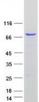 CDK5RAP3 Protein - Purified recombinant protein CDK5RAP3 was analyzed by SDS-PAGE gel and Coomassie Blue Staining