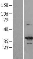 CDK6 Protein - Western validation with an anti-DDK antibody * L: Control HEK293 lysate R: Over-expression lysate