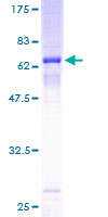 CDK6 Protein - 12.5% SDS-PAGE of human CDK6 stained with Coomassie Blue