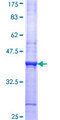 CDK6 Protein - 12.5% SDS-PAGE Stained with Coomassie Blue.