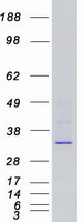CDK6 Protein - Purified recombinant protein CDK6 was analyzed by SDS-PAGE gel and Coomassie Blue Staining