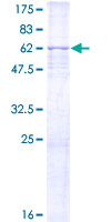 CDK7 Protein - 12.5% SDS-PAGE of human CDK7 stained with Coomassie Blue
