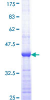 CDK7 Protein - 12.5% SDS-PAGE Stained with Coomassie Blue.