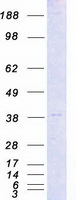CDK7 Protein - Purified recombinant protein CDK7 was analyzed by SDS-PAGE gel and Coomassie Blue Staining
