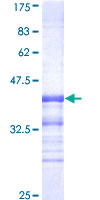CDK8 Protein - 12.5% SDS-PAGE Stained with Coomassie Blue.
