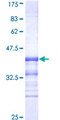 CDK8 Protein - 12.5% SDS-PAGE Stained with Coomassie Blue.