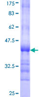 CDK9 Protein - 12.5% SDS-PAGE Stained with Coomassie Blue.