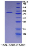 CDK9 Protein - Recombinant  Cyclin Dependent Kinase 9 By SDS-PAGE