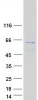 CDKAL1 Protein - Purified recombinant protein CDKAL1 was analyzed by SDS-PAGE gel and Coomassie Blue Staining