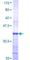 CDKL1 Protein - 12.5% SDS-PAGE Stained with Coomassie Blue.