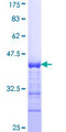 CDKL2 Protein - 12.5% SDS-PAGE Stained with Coomassie Blue.