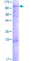 CDKL3 Protein - 12.5% SDS-PAGE of human CDKL3 stained with Coomassie Blue