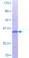 CDKL3 Protein - 12.5% SDS-PAGE Stained with Coomassie Blue.