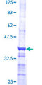 CDKL4 Protein - 12.5% SDS-PAGE Stained with Coomassie Blue.