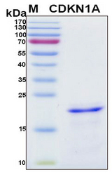 CDKN1A / WAF1 / p21 Protein - SDS-PAGE under reducing conditions and visualized by Coomassie blue staining