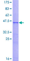 CDKN1A / WAF1 / p21 Protein - 12.5% SDS-PAGE of human CDKN1A stained with Coomassie Blue