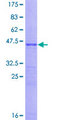 CDKN1A / WAF1 / p21 Protein - 12.5% SDS-PAGE of human CDKN1A stained with Coomassie Blue