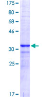 CDKN1A / WAF1 / p21 Protein - 12.5% SDS-PAGE Stained with Coomassie Blue.