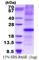 CDKN1A / WAF1 / p21 Protein