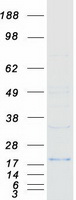 CDKN1A / WAF1 / p21 Protein - Purified recombinant protein CDKN1A was analyzed by SDS-PAGE gel and Coomassie Blue Staining