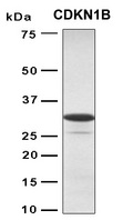 CDKN1B / p27 Kip1 Protein