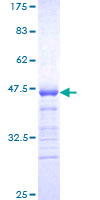 CDKN1B / p27 Kip1 Protein - 12.5% SDS-PAGE Stained with Coomassie Blue.