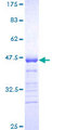 CDKN1B / p27 Kip1 Protein - 12.5% SDS-PAGE Stained with Coomassie Blue.