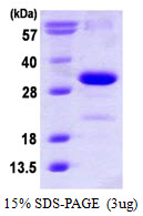 CDKN1B / p27 Kip1 Protein