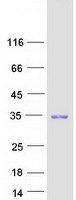 CDKN1B / p27 Kip1 Protein - Purified recombinant protein CDKN1B was analyzed by SDS-PAGE gel and Coomassie Blue Staining