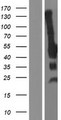 CDKN1C / p57 Kip2 Protein - Western validation with an anti-DDK antibody * L: Control HEK293 lysate R: Over-expression lysate