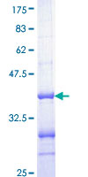 CDKN1C / p57 Kip2 Protein - 12.5% SDS-PAGE Stained with Coomassie Blue.