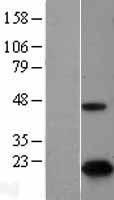 CDKN2A Protein - Western validation with an anti-DDK antibody * L: Control HEK293 lysate R: Over-expression lysate