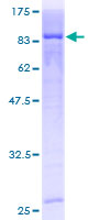 CDKN2AIP Protein - 12.5% SDS-PAGE of human CARF stained with Coomassie Blue