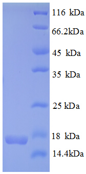 CDKN2AIPNL Protein