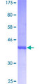 CDKN2B / p15 INK4b Protein - 12.5% SDS-PAGE of human CDKN2B stained with Coomassie Blue