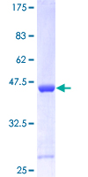 CDKN2C / p18 INK4c Protein - 12.5% SDS-PAGE of human CDKN2C stained with Coomassie Blue