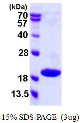 CDKN2C / p18 INK4c Protein