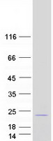 CDKN2C / p18 INK4c Protein - Purified recombinant protein CDKN2C was analyzed by SDS-PAGE gel and Coomassie Blue Staining