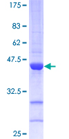 CDKN2D / p19 INK4d Protein - 12.5% SDS-PAGE of human CDKN2D stained with Coomassie Blue