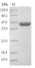CDKN2D / p19 INK4d Protein - (Tris-Glycine gel) Discontinuous SDS-PAGE (reduced) with 5% enrichment gel and 15% separation gel.